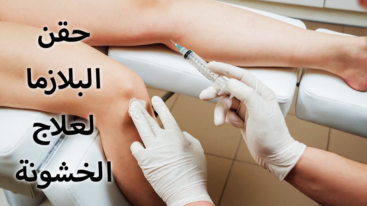 حقن البلازما و الصفائح الدموية لعلاج خشونة الركبة PRP