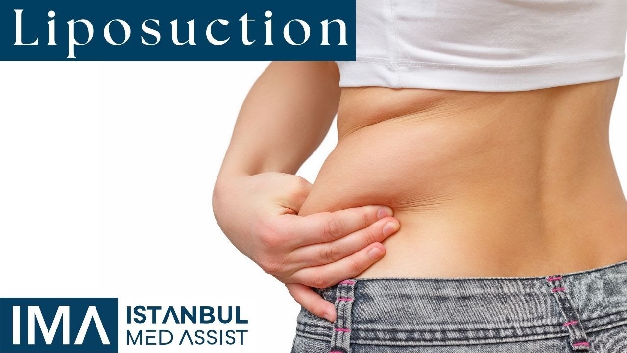 Liposuction - Istanbul Medical Assistance