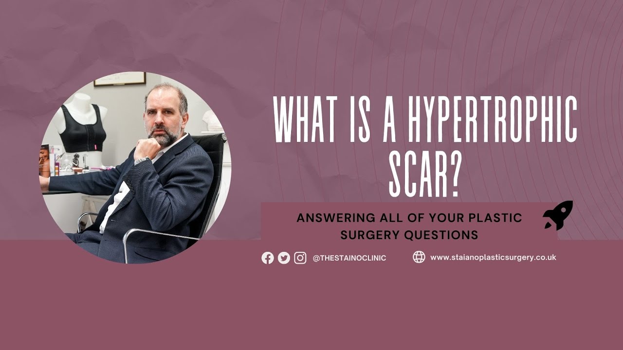 What Is A Hypertrophic Scar?