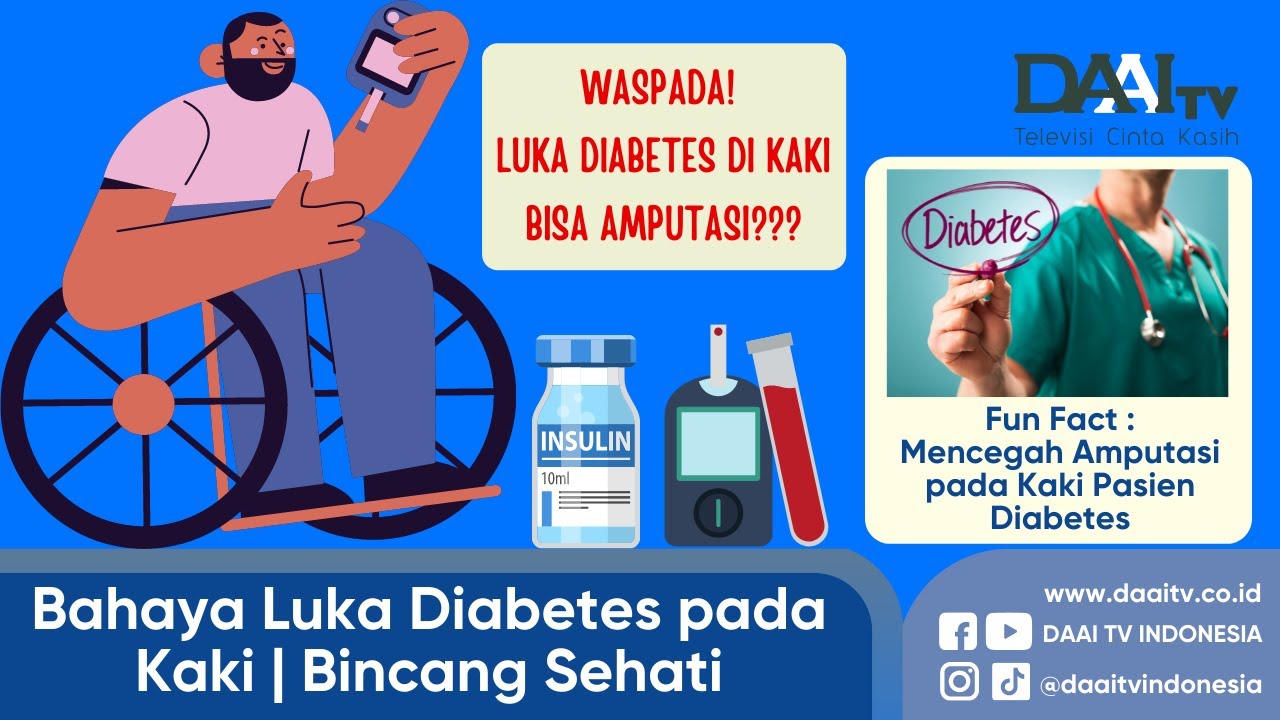 Bahaya Luka Diabetes pada Kaki | Bincang Sehati