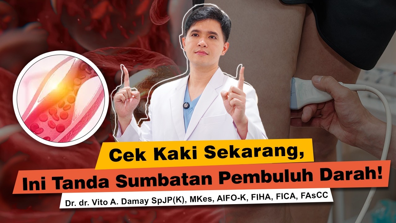 Dr Vito | Kaki Bengkak, Bukan Hal Biasa. Pahami ini baik baik
