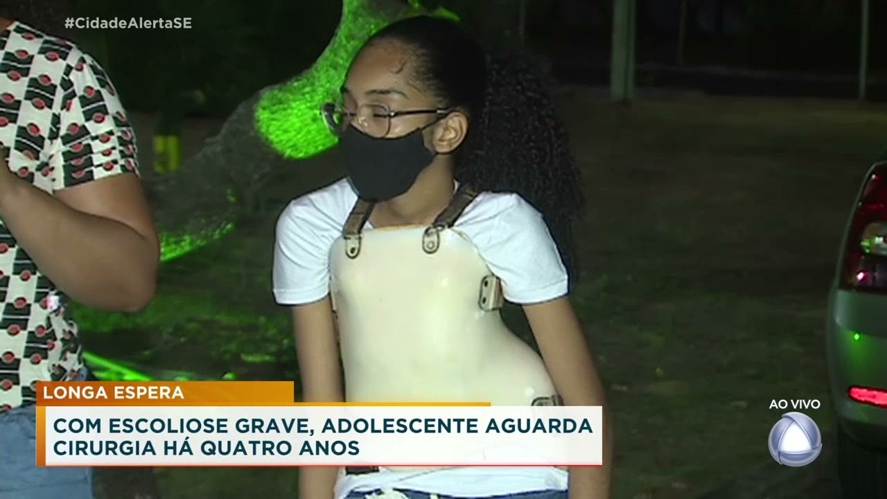 Adolescente com escoliose grave aguarda cirurgia há quatro anos - Cidade Alerta