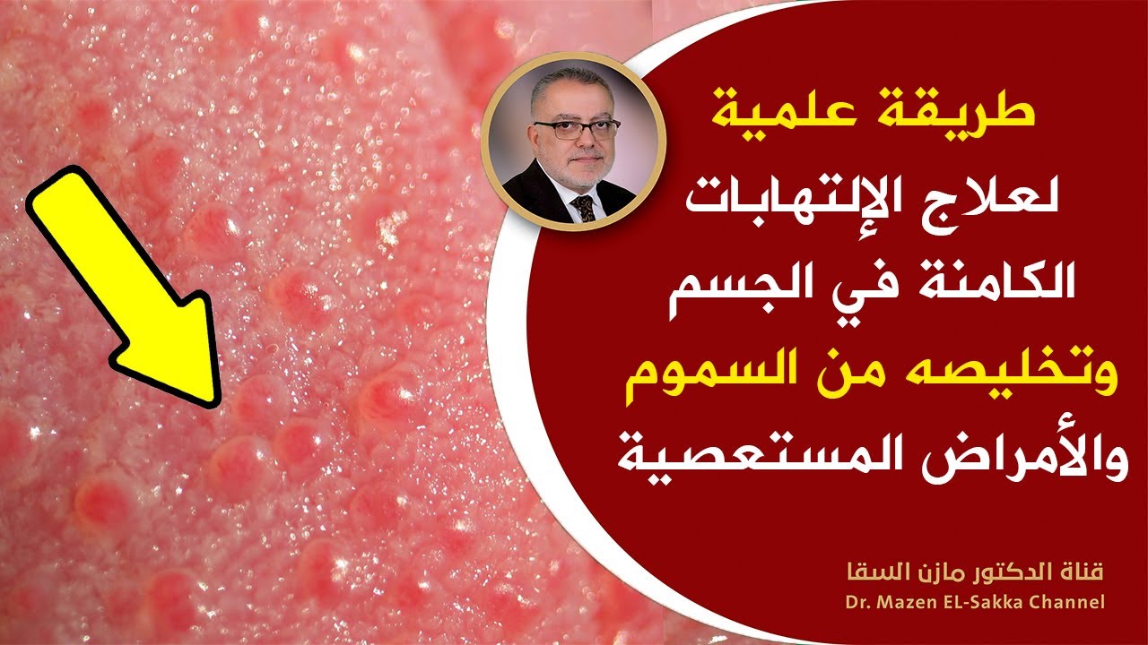 طريقة علمية لتقوية جهاز المناعة وتنظيف الجسم من السموم وعلاج الأمراض الصعبة والقضاء على أي التهابات