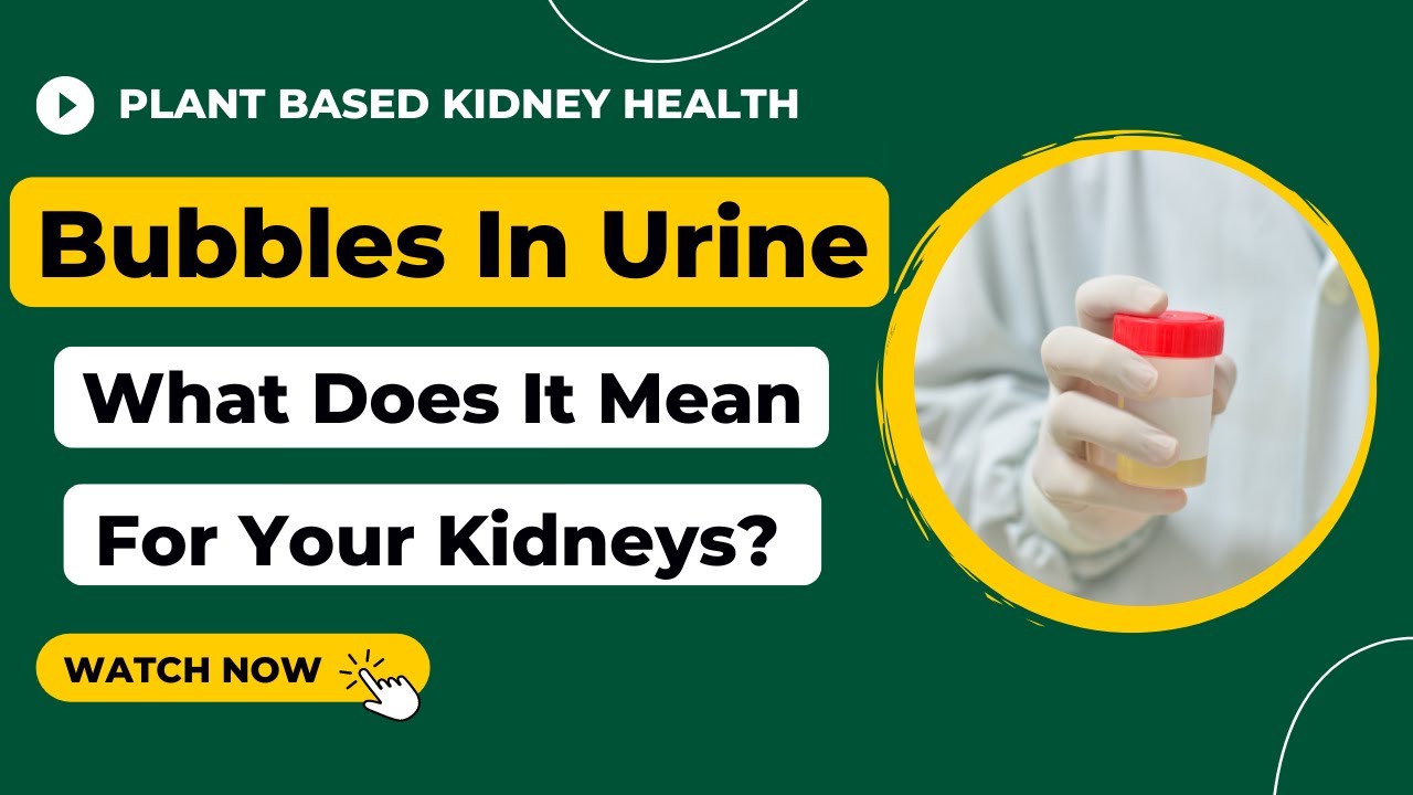 Bubbles In Urine. Does it Mean Kidney Disease & Proteinuria?