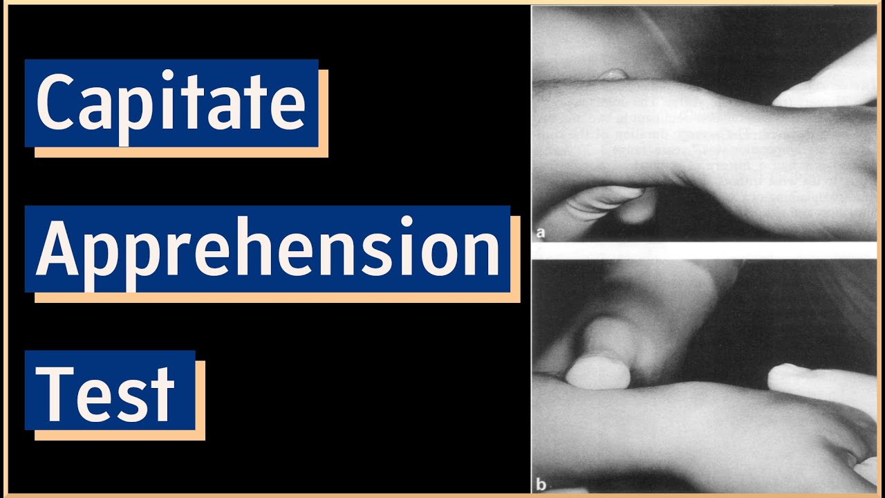 Capitate Apprehension Test | Carpal Instability