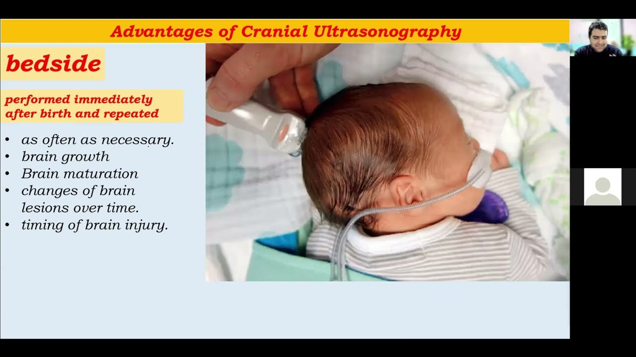 part 1 :: Road map for cranial ultrasound training .. Dr.Mohamed Soliman