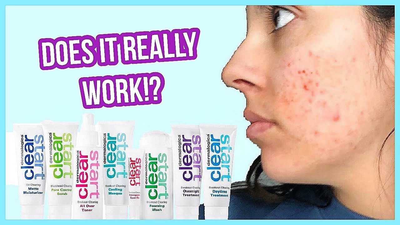 IT CLEARED MY ACNE?! Dermalogica Clear Start Review