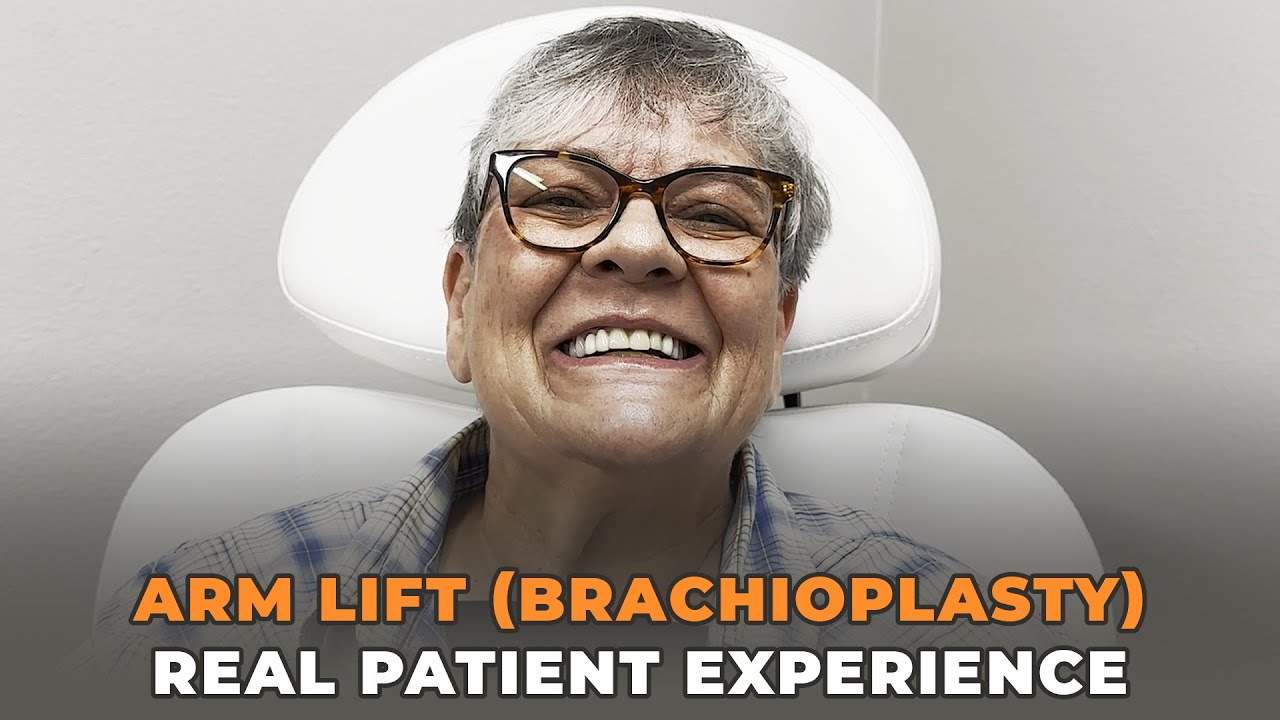 Arm Lift (Brachioplasty) - Real Patient Experience