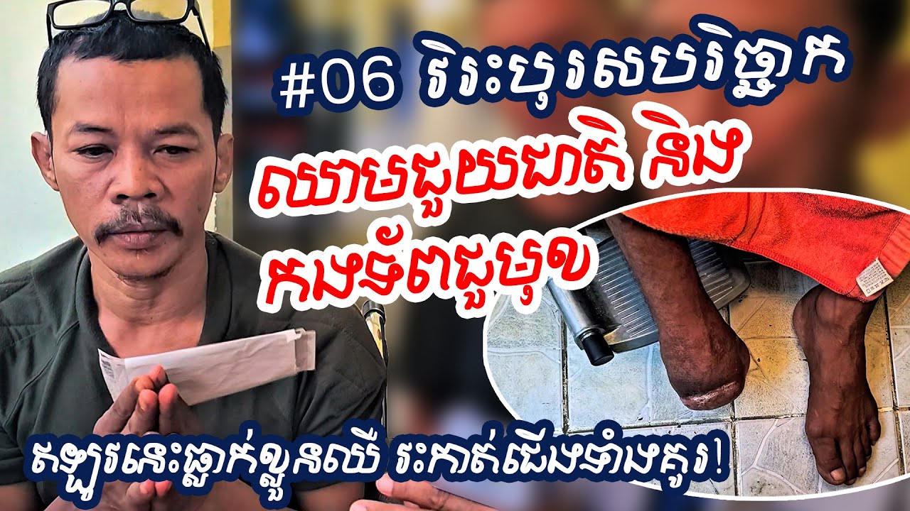 #06 វិរះបុរសបរិច្ឆាកឈាមជួយជាតិ និង កងទ័ពជួមុខ ឥឡូវនេះធ្លាក់ខ្លួនឈឺ វះកាត់ជើងទាំងគូរ!