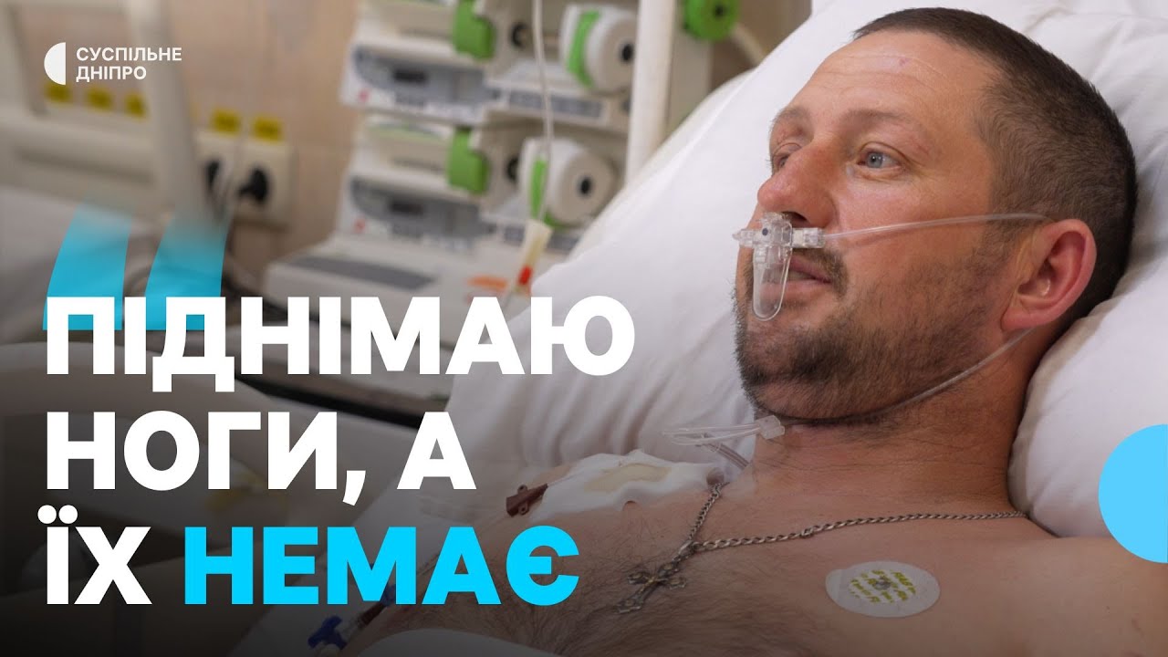 Вижив після підриву на міні: медики Дніпропетровщини лікують пораненого військового