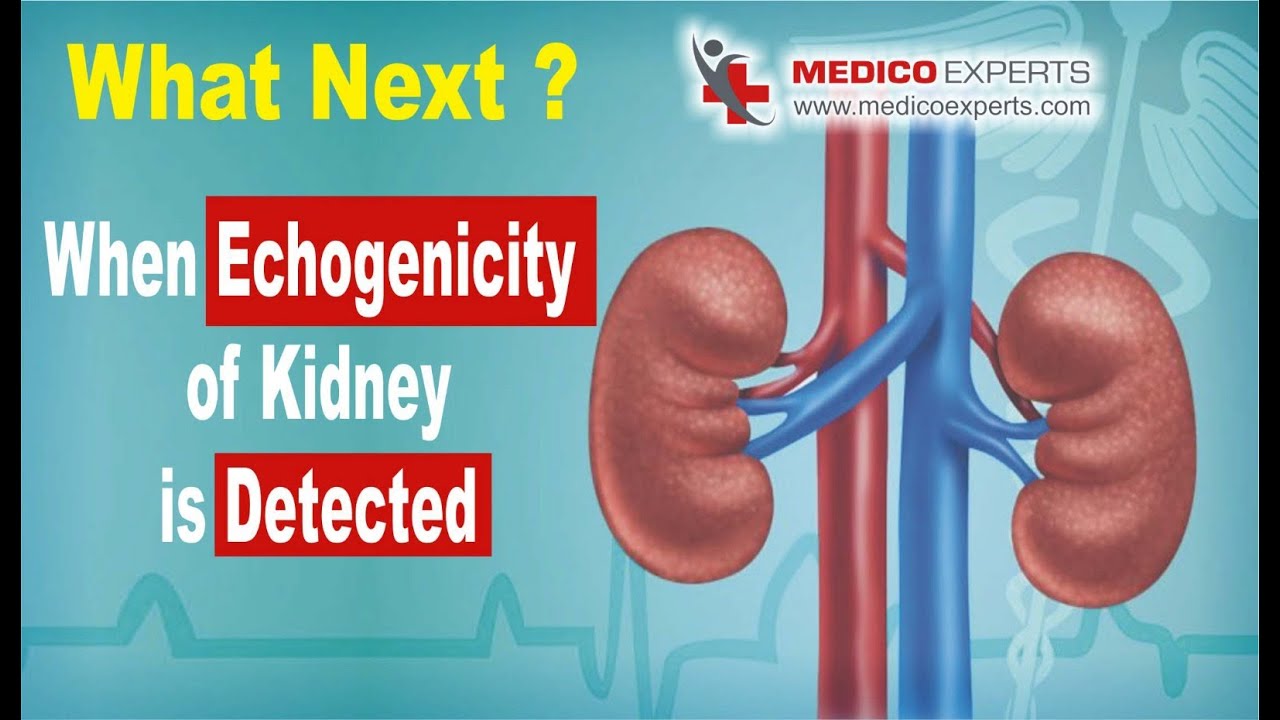 What Next?... When Echogenicity of Kidney is Detected