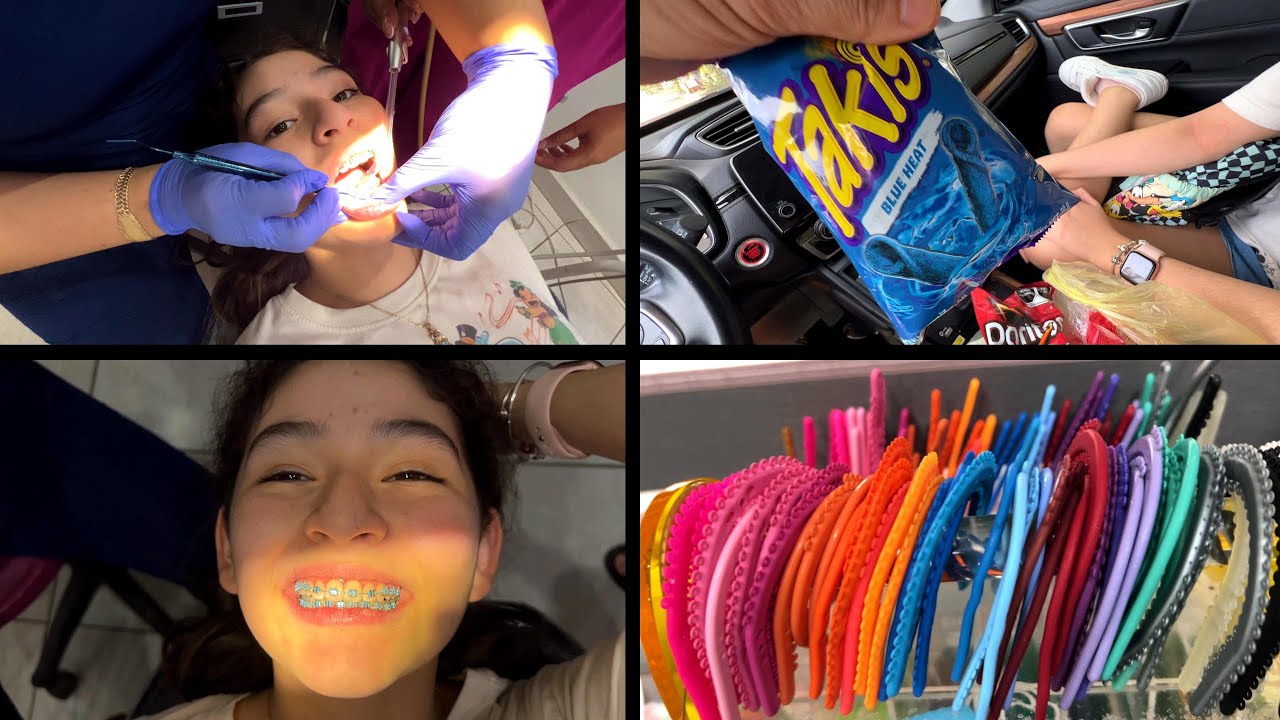 Ajuste de BRACKETS y Cambio de LIGAS | Los Yeyus Family Vlogs