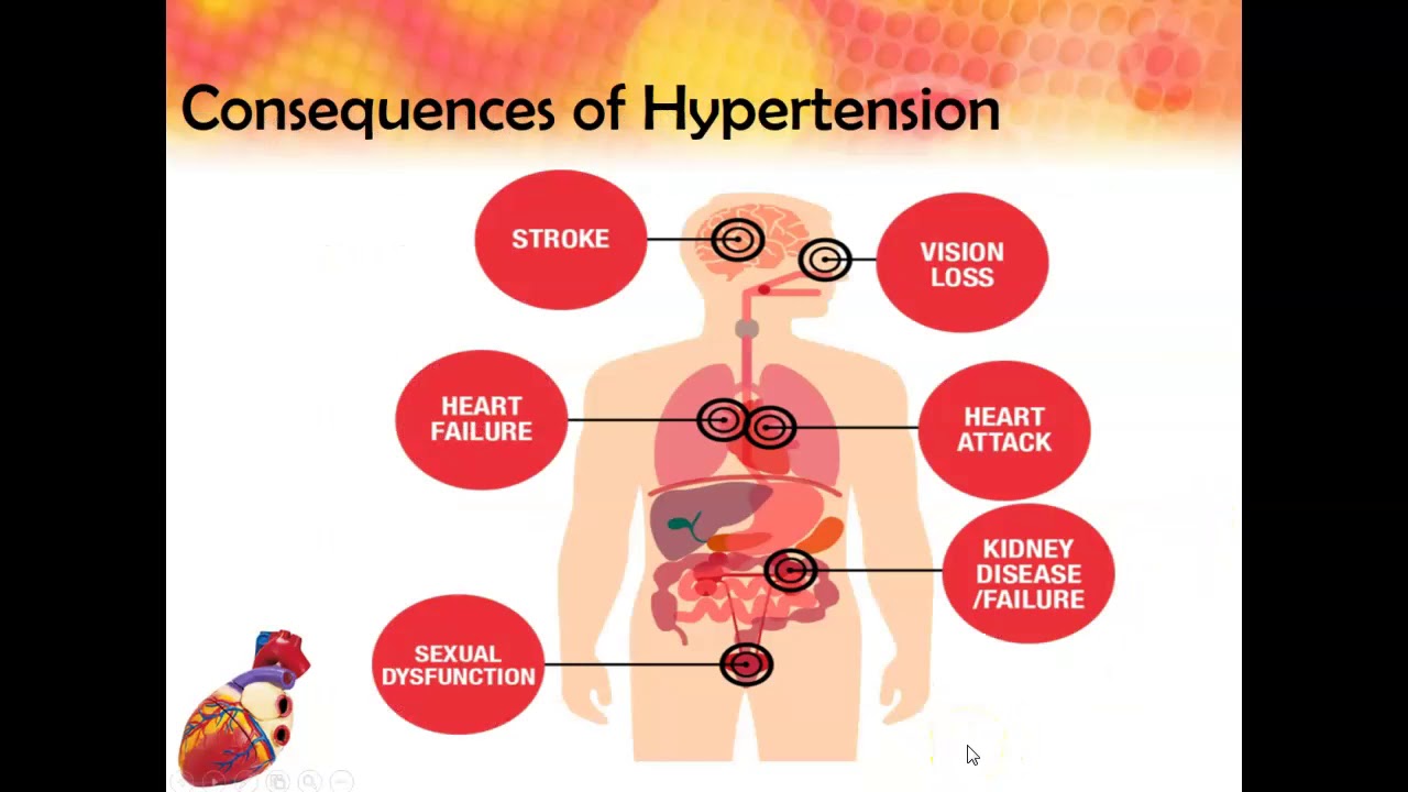 Hypertension Overview Fall 2019