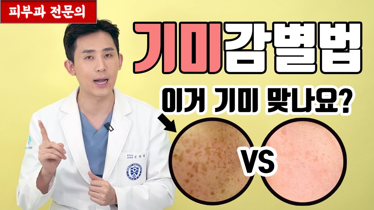 내 얼굴에 기미가 맞나요? - 기미 감별법  [피부과전문의 피부심]