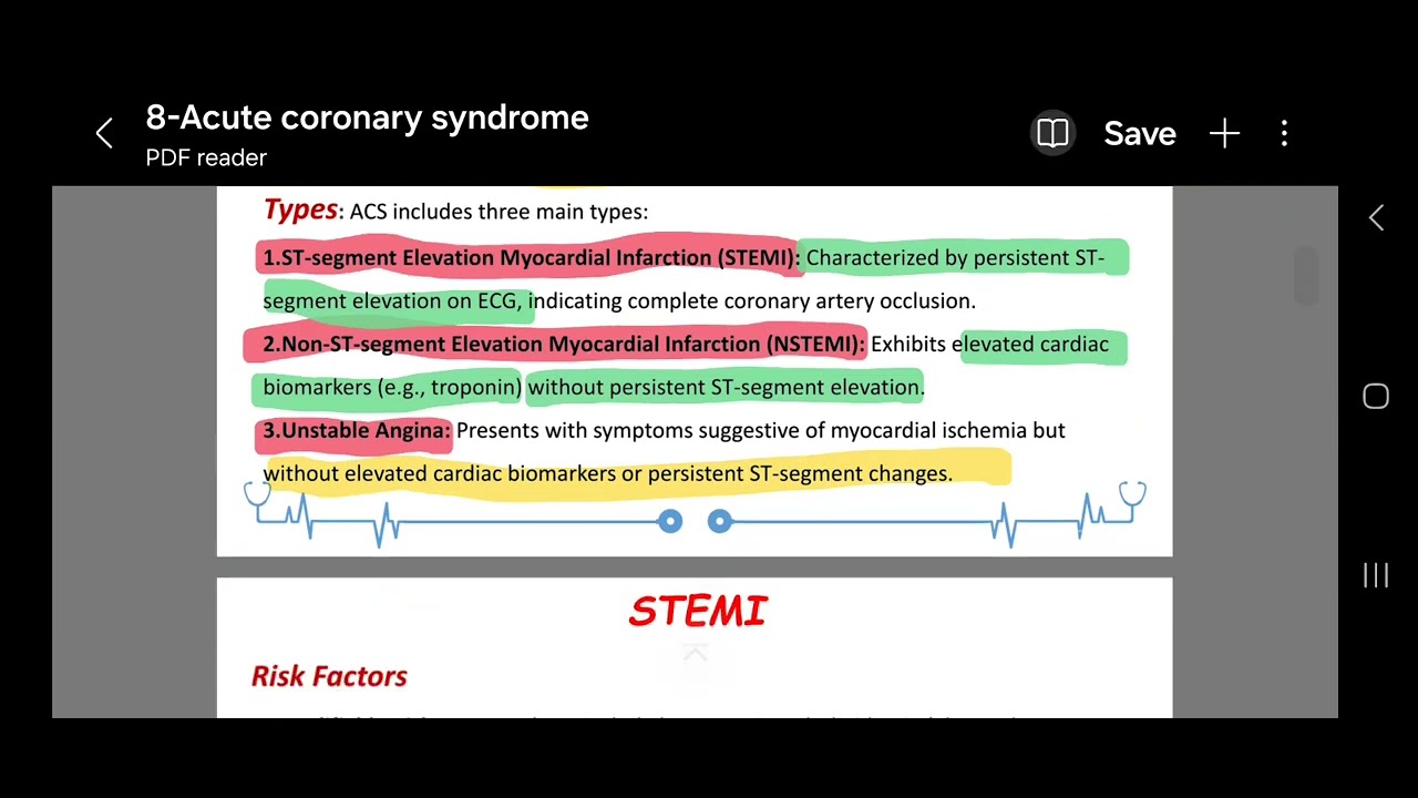 Acute Coronary Syndrome