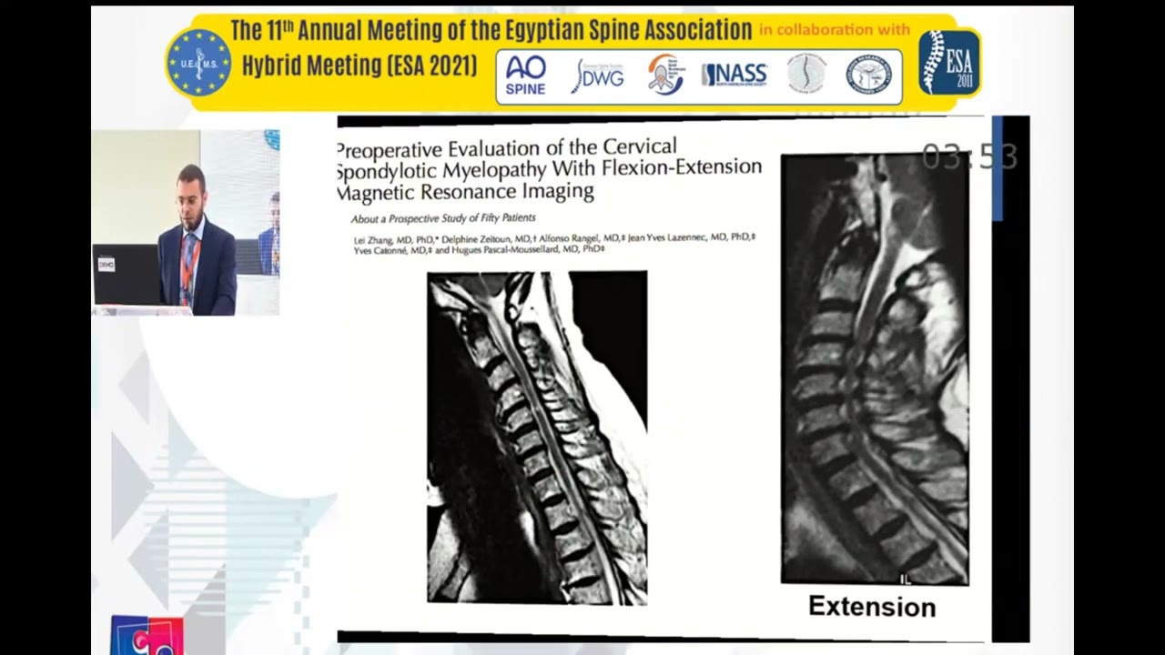 ESA 2021 Real time cervical MRI