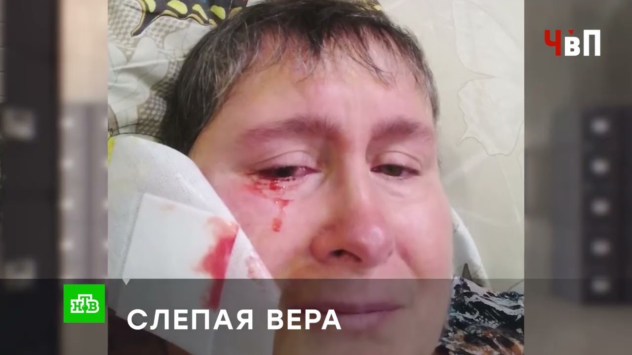 «СЛЕПАЯ ВЕРА»