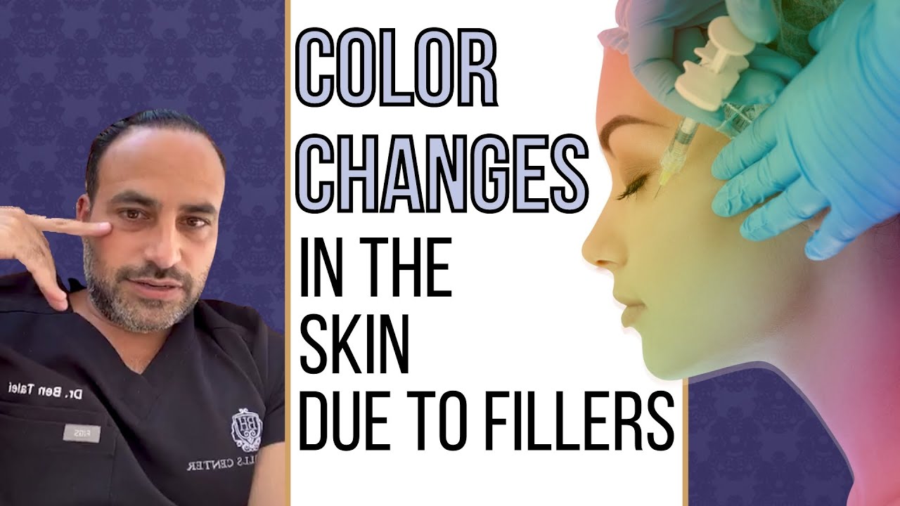 Color Changes in the Skin from Fillers | Dr.  Ben Talei | Beverly Hills CA
