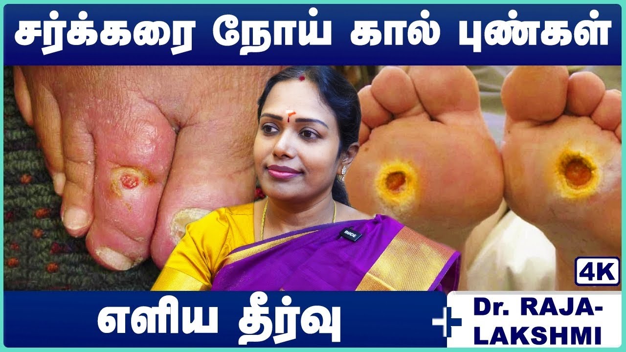 புண் விரைவில் குணமாக | Sugar Pun Treatment | Sugar Pun Treatment in Tamil | Cosmo Health