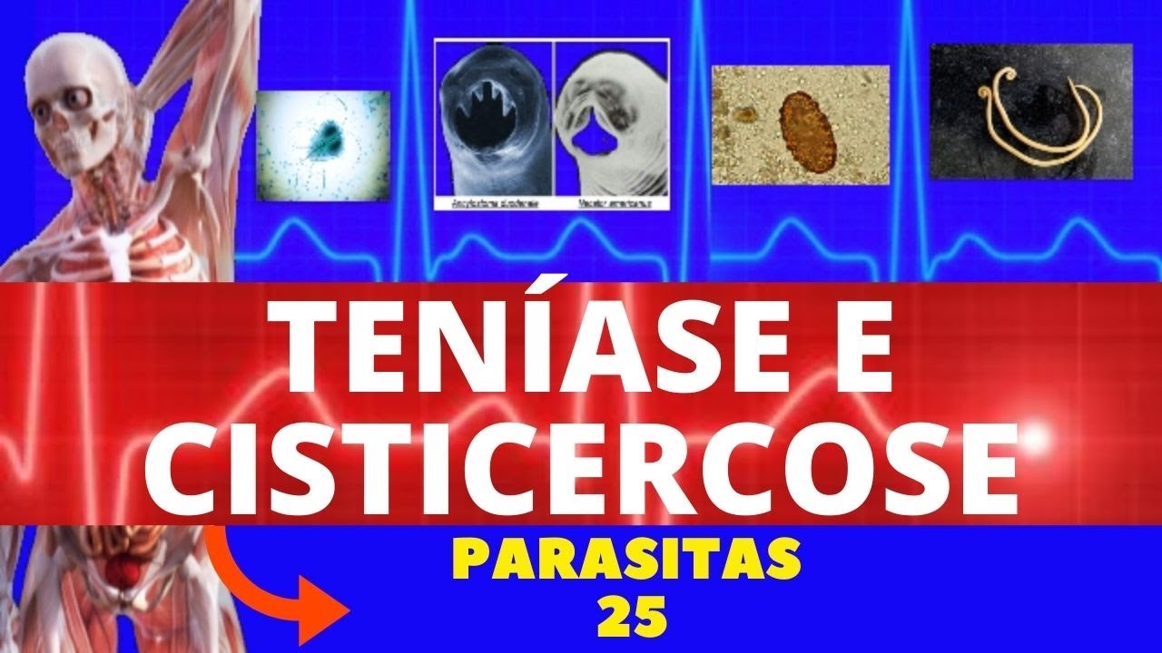 TEN&Iacute;ASE E CISTICERCOSE - T&Ecirc;NIA SOLIUM E T&Ecirc;NIA SARGINATA (SOLIT&Aacute;RIA) - PARASITOLOGIA | INFECTOLOGIA
