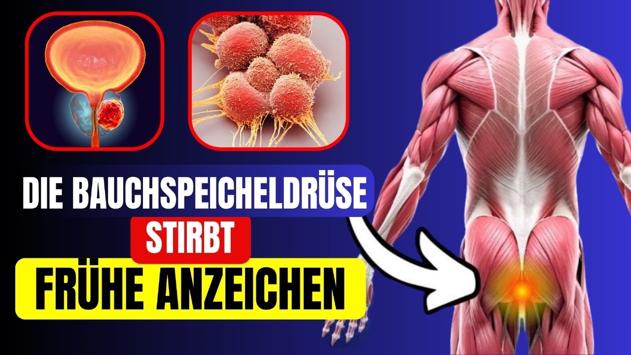 6 Symptome von BAUCHSPEICHELDR&Uuml;SENKREBS, die SIE SCHOCKIEREN werden | Kritische Warnzeichen