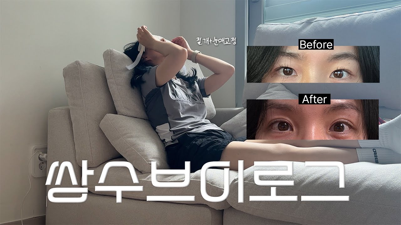 VLOG ｜쌍수했어요,,! 수술당일~5일차 쌍수 브이로그👀(feat. 현재와 쌍수 꿀템 추천)