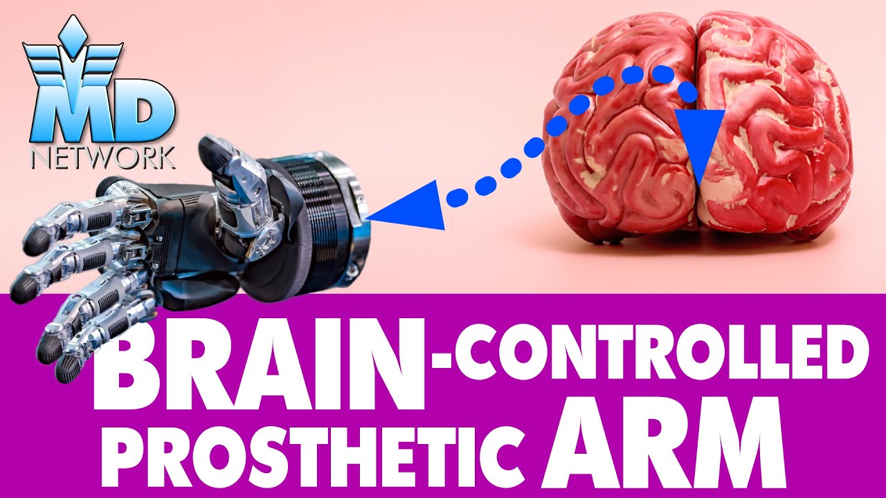 Brain-Controlled Prosthetic Arm: How The 2-Way Feedback Bionic Arm Works.