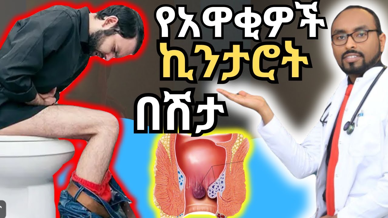 የአዋቂዎች የኪንታሮት በሽታ (Hemorrhoids) መንስኤ እና መፍትሄዎች | Causes and remedies for the hemorrhoids.