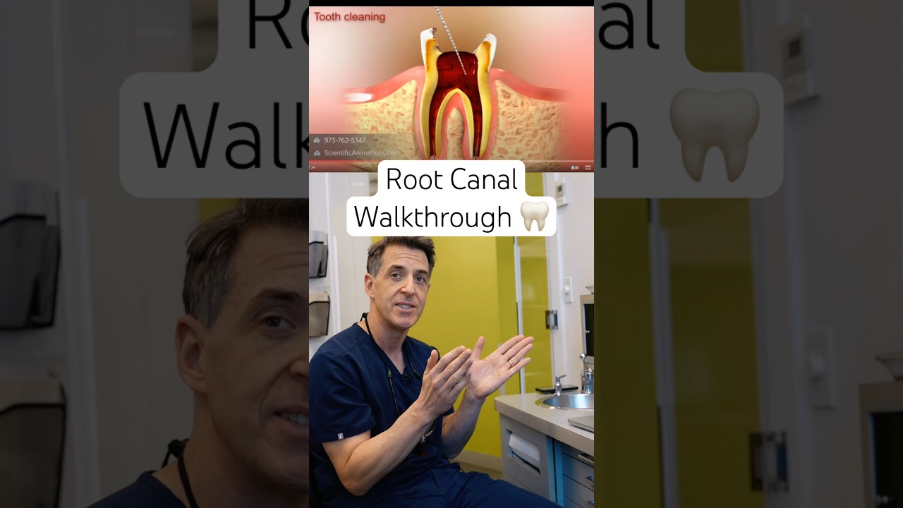 Root Canal Myths Busted: What Actually Happens at the Dentist