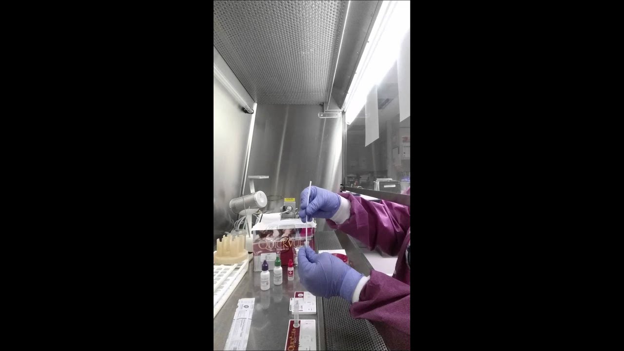 Rapid strep screen