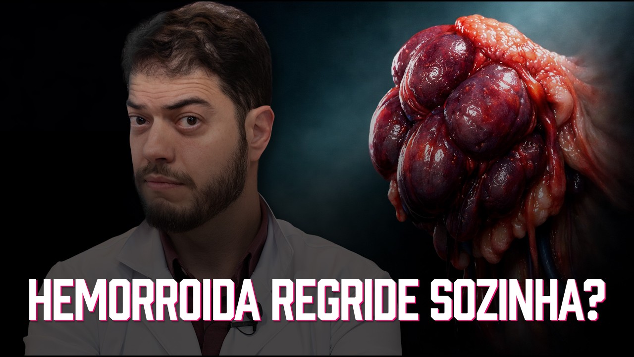 Hemorroida Regride Sozinha? Entenda Quando Pode Diminuir