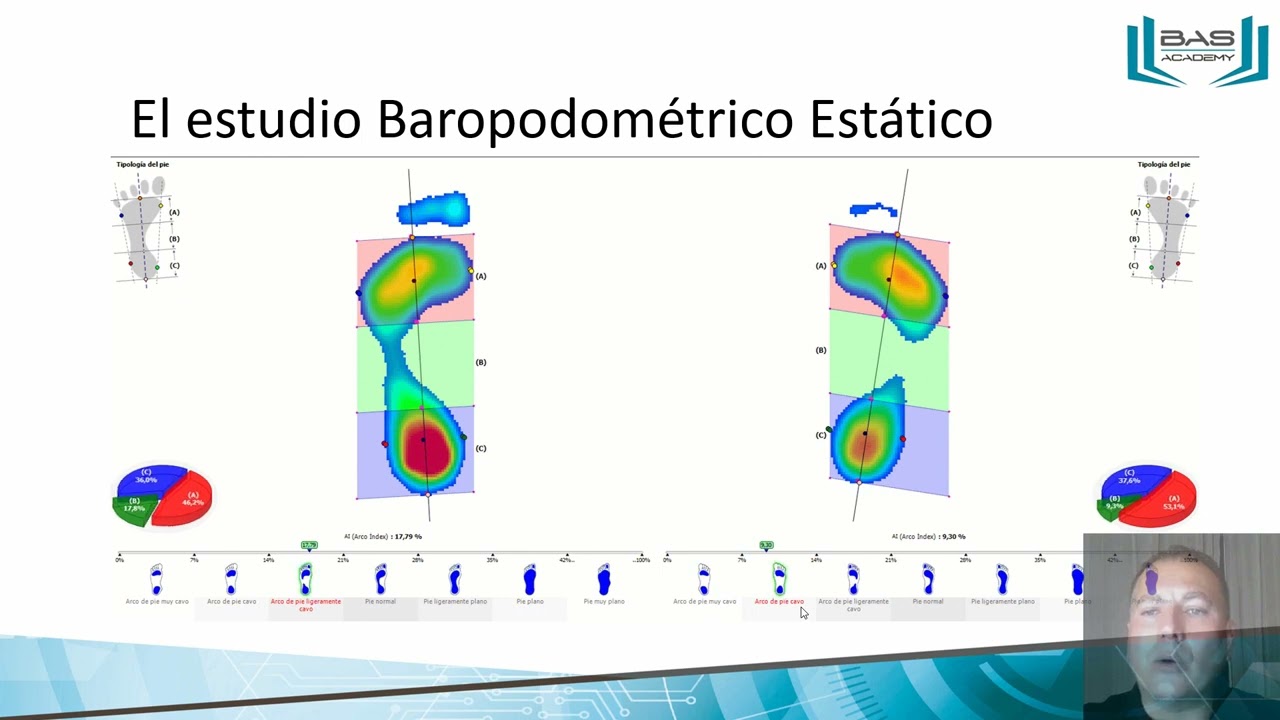 Baropodometría. V CONGRESO PODOLOGIA PERU PODOREH
