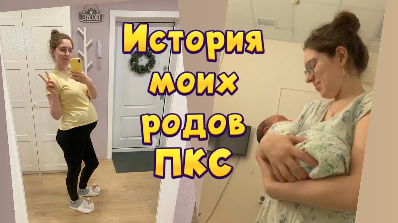 ИСТОРИЯ МОИХ РОДОВ 🤱🏻КЕСАРЕВО СЕЧЕНИЕ🏥 ПРИЧИНЫ, ОПЕРАЦИЯ 🔪