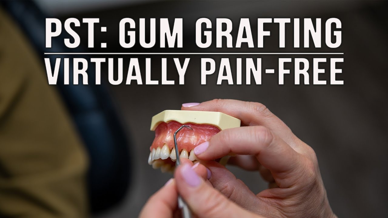 The Pinhole Surgical Technique, how to correct receding gums without stitches