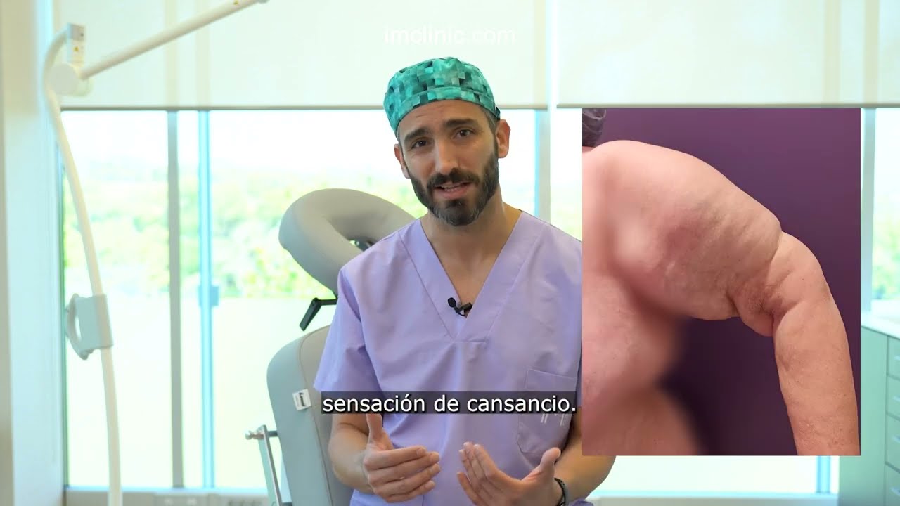 Lipedema: Todo lo que necesitas saber