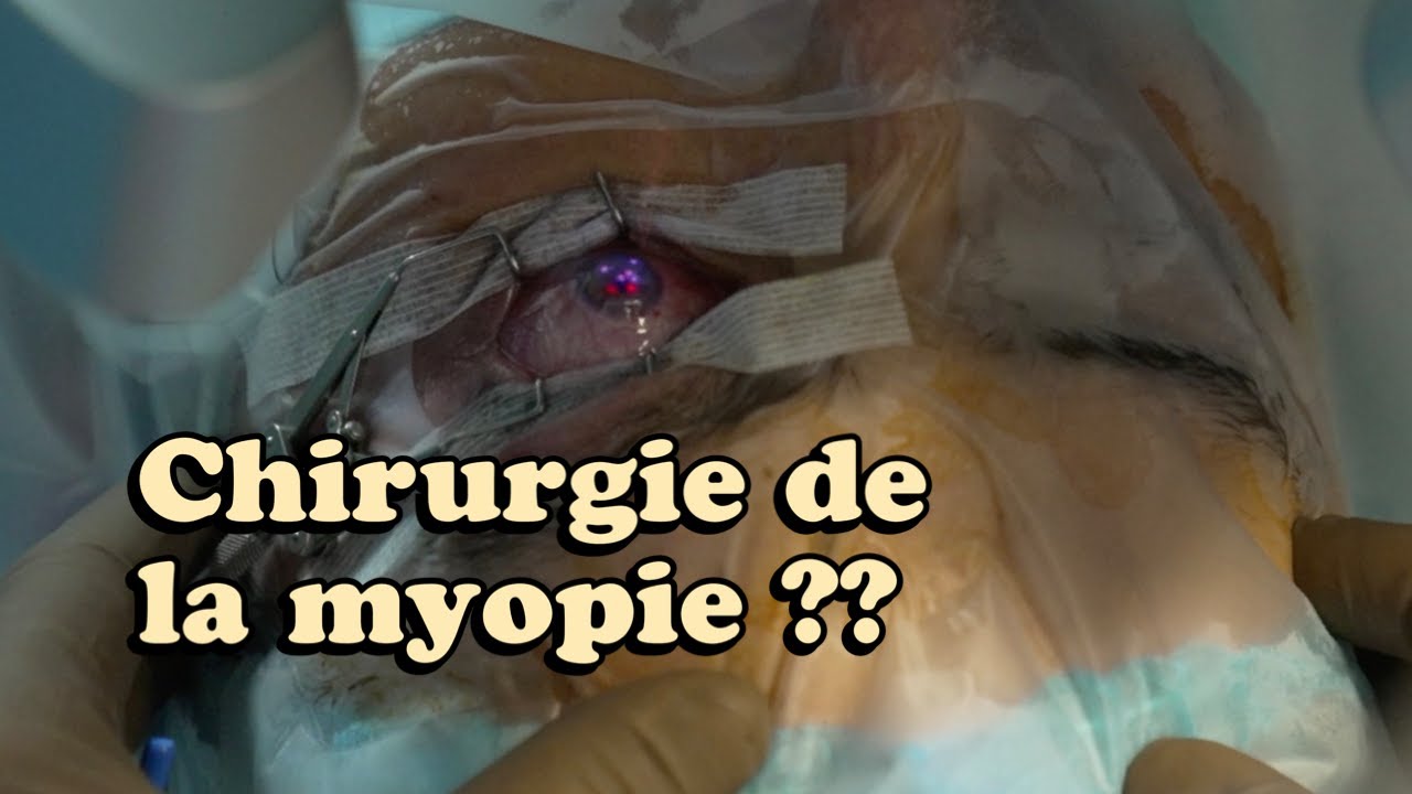 Comment se passe une chirurgie de la myopie ?