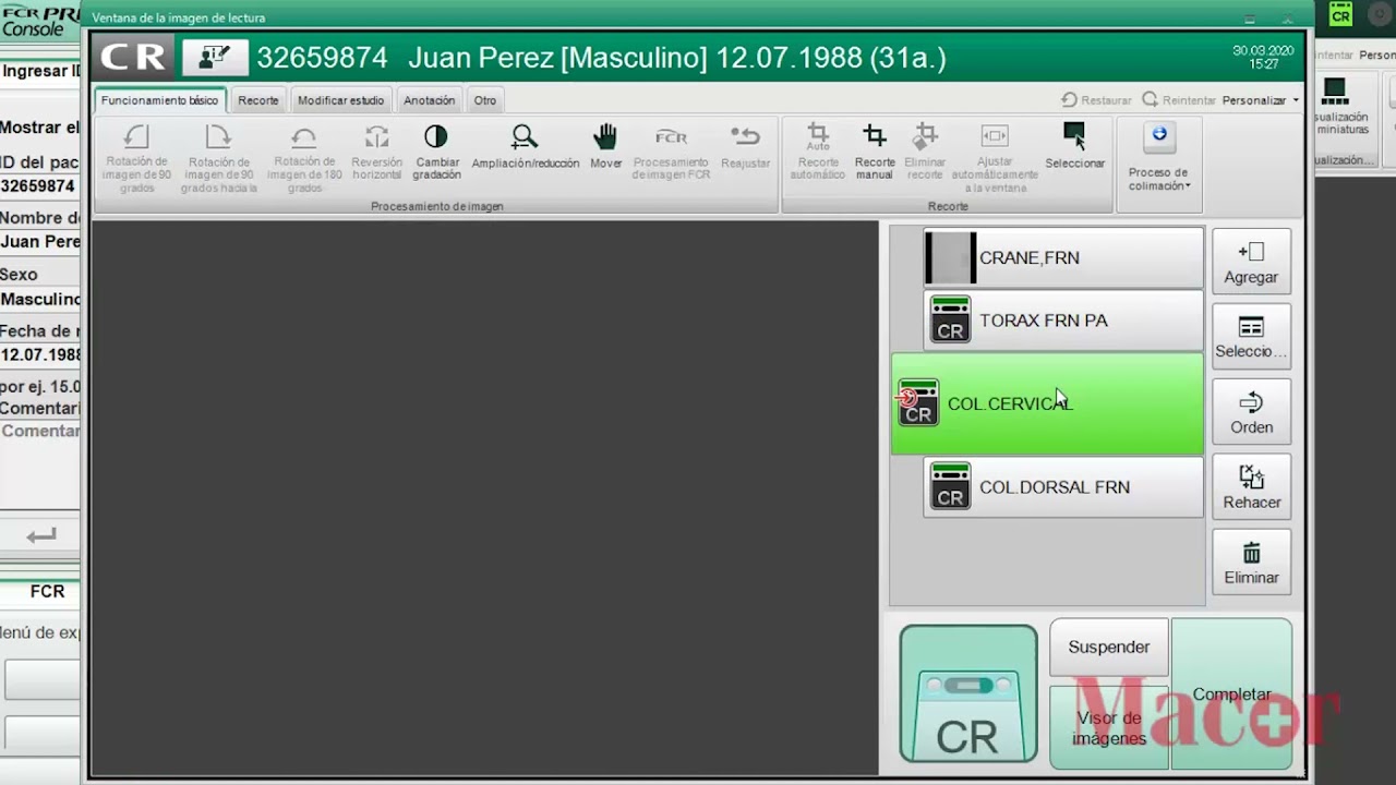Tutorial   Prima Console - Escaneo, cambio y eliminación de vistas