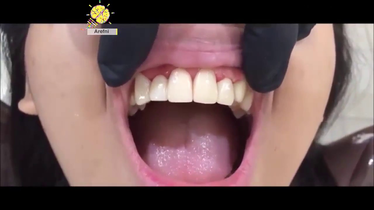 ❀ Top Denstist Tricks #1 ❀ Top 10 tecniche nel mondo dei dentisti ❀ odontoiatria soddisfacente ❀
