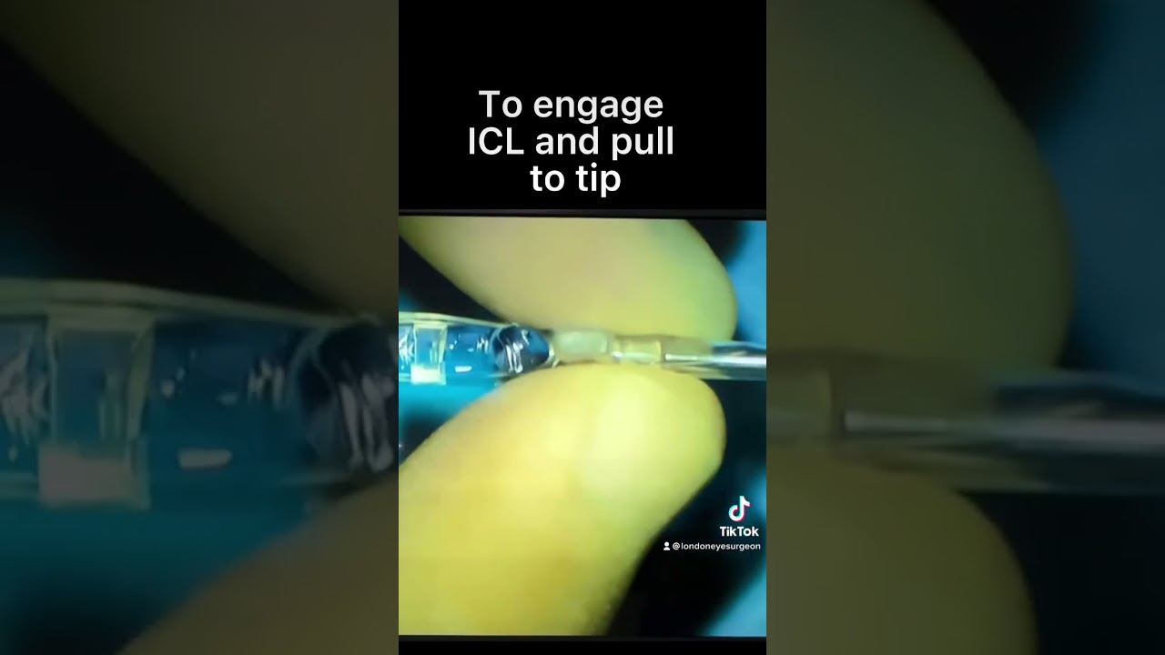 Steps to load an EVO ICL implant - let’s go!