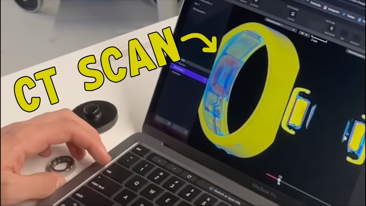 What's inside the Oura Ring? (Gen 3 and 2)
