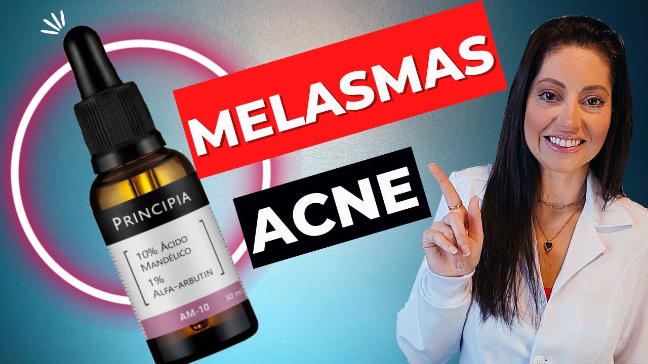 MELASMAS e Manchas de Acne: Ácido Mandélico 10% com Alfa-Arbutin 1% PRINCIPIA