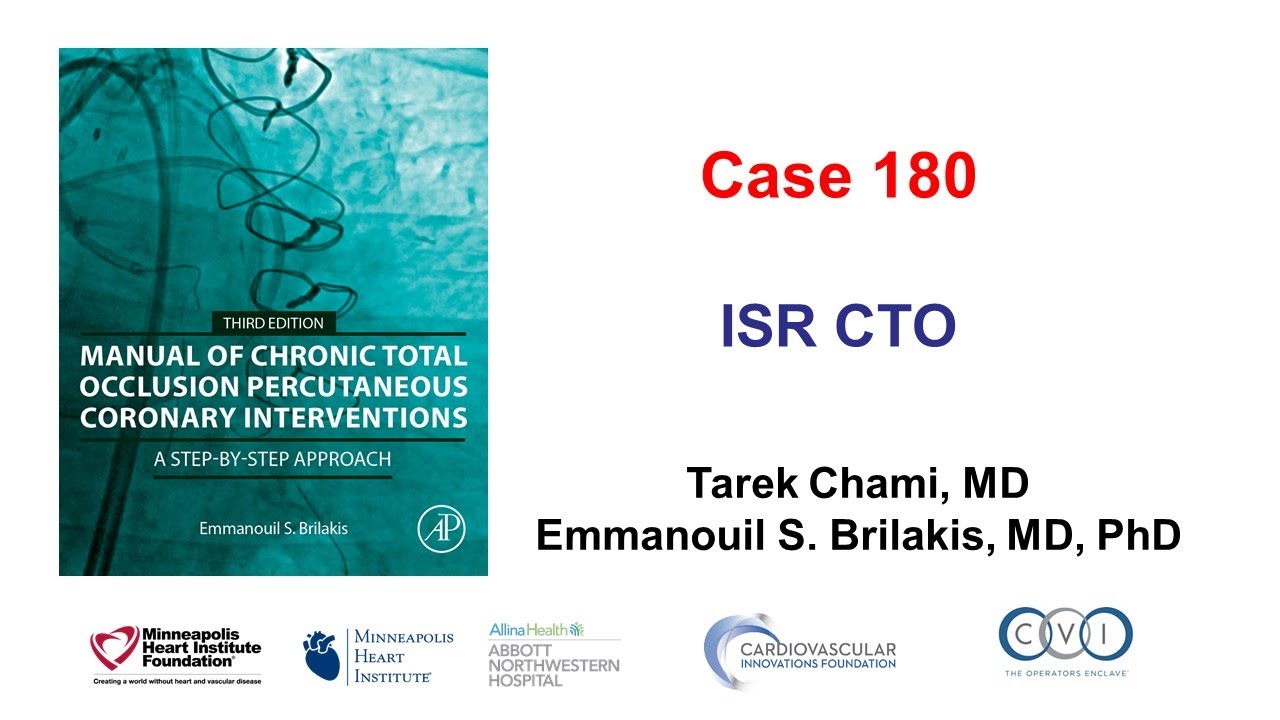 Дело 180: Руководство CTO PCI - ISR CTO