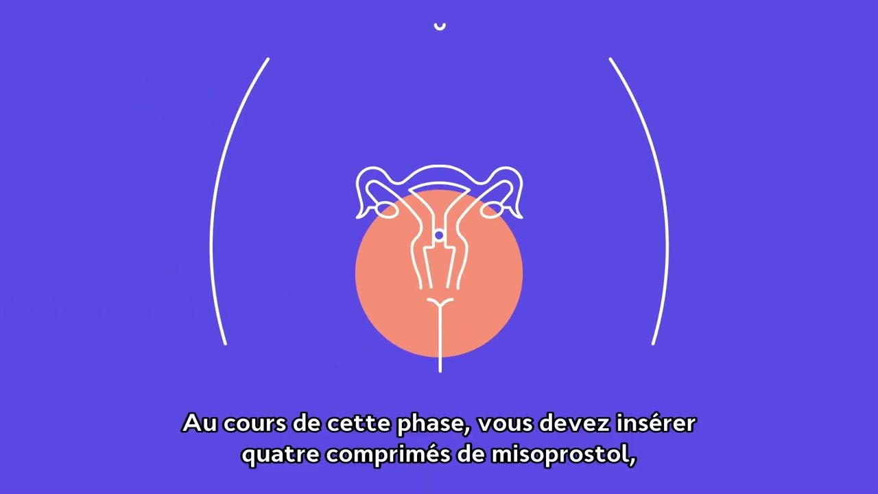 L’avortement médicamenteux