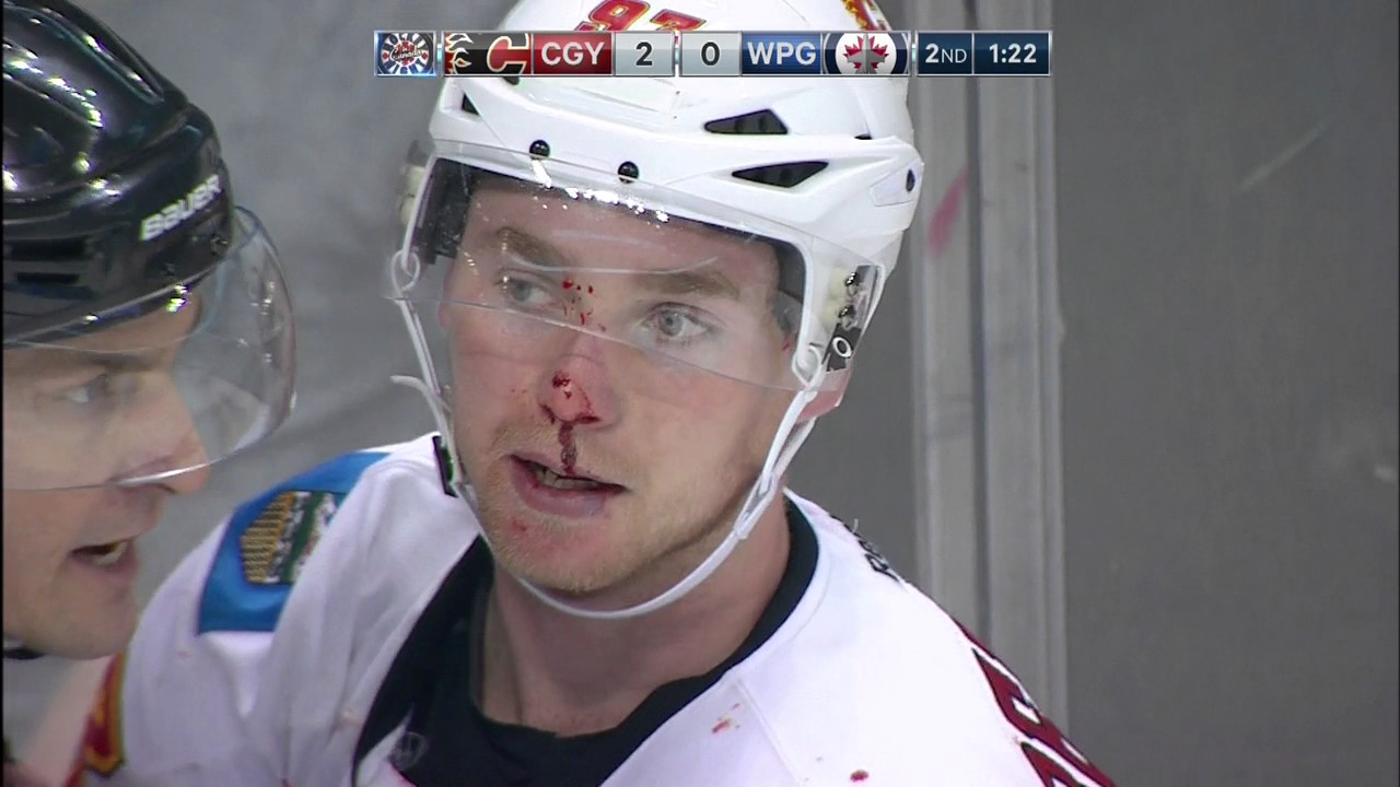Gotta See It: Trouba, Bennett pick offence over defence in spirited fight