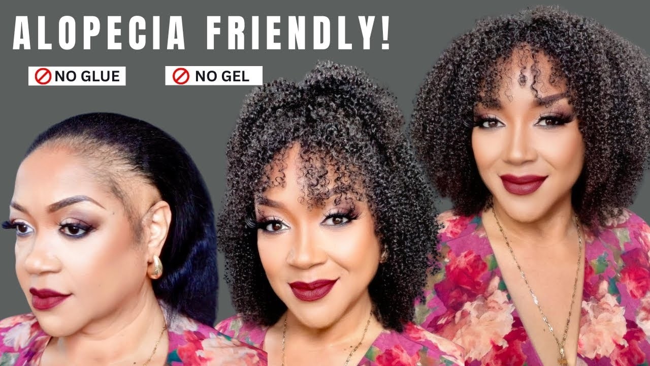I FINALLY Found a Truly Glueless Wig for Alopecia Girls 😭✨ No Glue, No Stress!