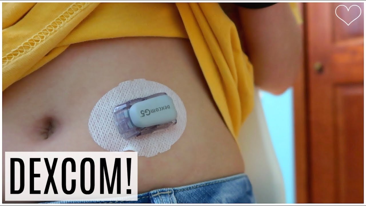 DEXCOM G5 INSERTION (Step By Step Tutorial) | LainaElyseVlogs