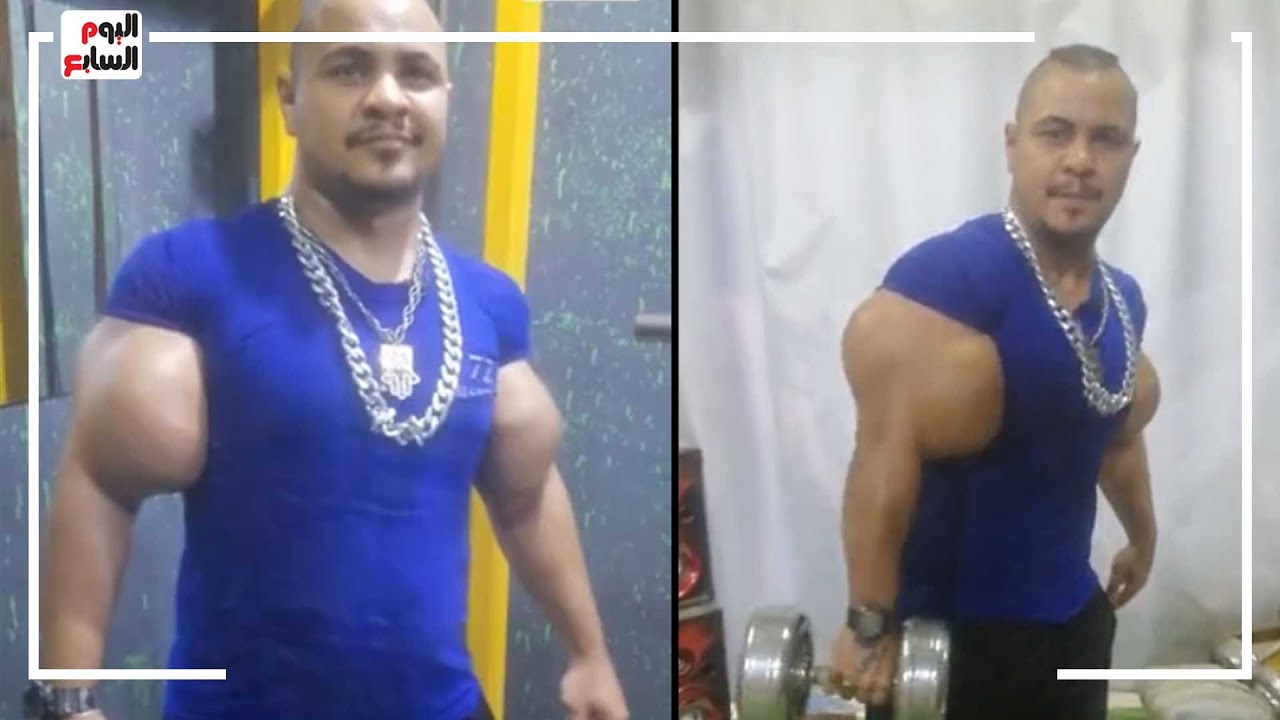 شكله يخض ومش هتصدق بيشيل كام كيلو.. رحنا الجيم مع صاحب أغرب دراع فى مصر