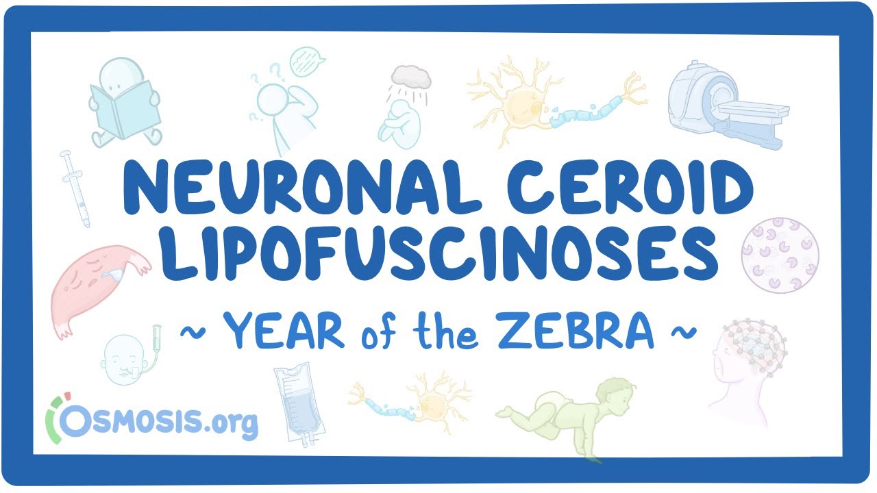 Neuronal ceroid lipofuscinoses (Year of the Zebra)
