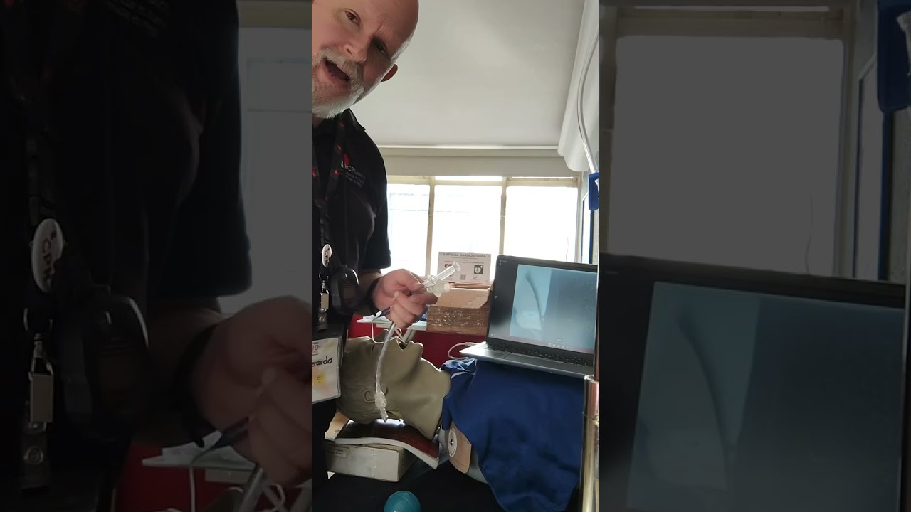 Videolaringoscopía con estilete maleable.