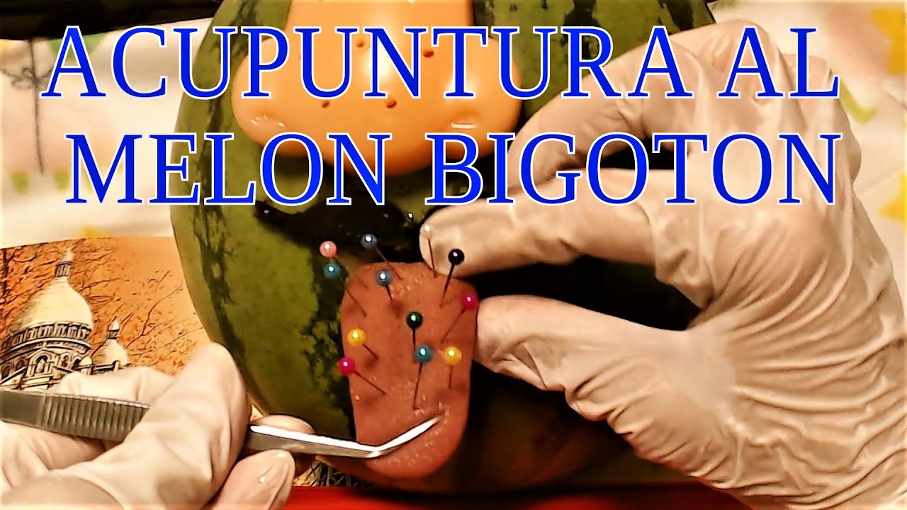 ASMR ACUPUNTURA EN LA LENGUA DE UN MELON🍉VISITA AL DOCTOR👅SATISFYING AUDIOVISUAL TINGLES👅TONGUE